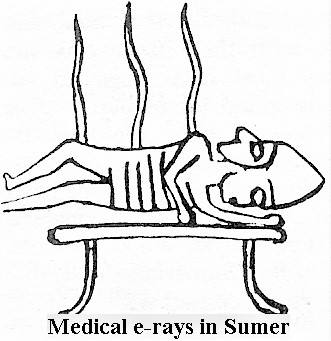 5b - Medical - X-rays in Sumer