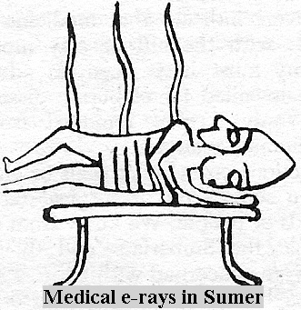 1 - ancient medical X-rays in Sumer